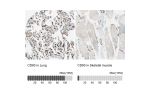 Immunohistochemistry analysis in human lung and skeletal muscle tissues using HPA009300 antibody. Corresponding CD93 RNA-seq data are presented for the same tissues.
