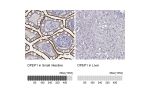 Immunohistochemistry analysis in human small intestine and liver tissues using HPA009426 antibody. Corresponding DPEP1 RNA-seq data are presented for the same tissues.