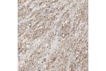 Immunohistochemical staining of human prostate shows strong cytoplasmic positivity in smooth muscle cells.