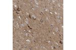 Immunohistochemical staining of human cerebral cortex shows cytoplasmic positivity in neuronal cells.