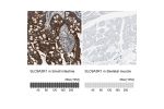 Immunohistochemistry analysis in human small intestine and skeletal muscle tissues using Anti-SLC9A3R1 antibody. Corresponding SLC9A3R1 RNA-seq data are presented for the same tissues.