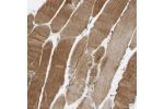 Immunohistochemical staining of human skeletal muscle shows strong cytoplasmic positivity in myocytes.