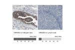 Immunohistochemistry analysis in human fallopian tube and lymph node tissues using HPA009678 antibody. Corresponding GRAMD3 RNA-seq data are presented for the same tissues.
