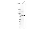 Western blot analysis in human cell line SCLC-21H.