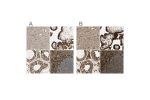 Immunohistochemical staining of human cerebral cortex, placenta, testis and tonsil using Anti-CANX antibody HPA009696 (A) shows similar protein distribution across tissues to independent antibody HPA009433 (B).