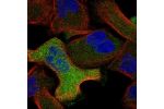 Immunofluorescent staining of human cell line RH-30 shows localization to cytosol.