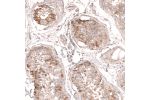 Immunohistochemical staining of human testis shows moderate to strong cytoplasmic positivity in subsets of cells in seminiferous ducts.