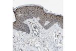 Immunohistochemical staining of human skin shows strong nuclear positivity in subset of squamous epithelial cells.