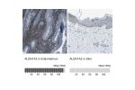 Immunohistochemistry analysis in human endometrium and skin tissues using HPA010022 antibody. Corresponding ALDH1A2 RNA-seq data are presented for the same tissues.