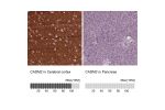 Immunohistochemistry analysis in human cerebral cortex and pancreas tissues using HPA010024 antibody. Corresponding CADM2 RNA-seq data are presented for the same tissues.