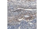 Immunohistochemical staining of human ovary shows moderate cytoplasmic positivity in connective tissues.