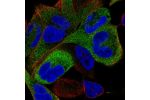 Immunofluorescent staining of human cell line RH-30 shows localization to cytosol.