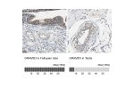 Immunohistochemistry analysis in human fallopian tube and testis tissues using Anti-GRAMD3 antibody. Corresponding GRAMD3 RNA-seq data are presented for the same tissues.