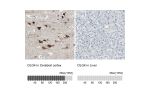 Immunohistochemistry analysis in human cerebral cortex and liver tissues using Anti-DLG4 antibody. Corresponding DLG4 RNA-seq data are presented for the same tissues.