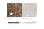 Immunohistochemistry analysis in human liver and skeletal muscle tissues using HPA010136 antibody. Corresponding POR RNA-seq data are presented for the same tissues.