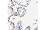 Immunohistochemical staining of human placenta shows strong granular cytoplasmic positivity in trophoblastic cells.