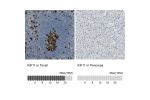 Immunohistochemistry analysis in human tonsil and pancreas tissues using HPA010568 antibody. Corresponding KIF11 RNA-seq data are presented for the same tissues.