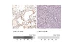 Immunohistochemical staining of human spleen shows moderate to strong cytoplasmic positivity in cells in red pulp.