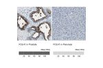 Immunohistochemistry analysis in human prostate and pancreas tissues using HPA010593 antibody. Corresponding FOLH1 RNA-seq data are presented for the same tissues.