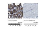 Immunohistochemistry analysis in human stomach and skeletal muscle tissues using Anti-GOLM1 antibody. Corresponding GOLM1 RNA-seq data are presented for the same tissues.