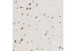 Immunohistochemical staining of human cerebral cortex shows moderate cytoplasmic positivity in neuronal cells.