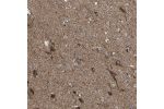 Immunohistochemical staining of human cerebral cortex shows positivity in neuronal cells.