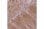 Immunohistochemical staining of human smooth muscle shows moderate cytoplasmic positivity in smooth muscle cells.