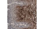 Immunohistochemical staining of human esophagus shows strong cytoplasmic positivity in squamous epithelial cells.