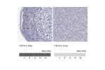 Immunohistochemistry analysis in human skin and liver tissues using HPA010734 antibody. Corresponding CD1A RNA-seq data are presented for the same tissues.