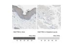 Immunohistochemistry analysis in human skin and skeletal muscle tissues using HPA010775 antibody. Corresponding NECTIN4 RNA-seq data are presented for the same tissues.