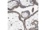 Immunohistochemical staining of human placenta shows strong granular cytoplasmic positivity in trophoblastic cells.