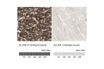 Immunohistochemistry analysis in human parathyroid gland and skeletal muscle tissues using HPA010926 antibody. Corresponding ALCAM RNA-seq data are presented for the same tissues.
