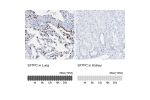Immunohistochemistry analysis in human lung and kidney tissues using HPA010928 antibody. Corresponding SFTPC RNA-seq data are presented for the same tissues.