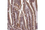 Immunohistochemical staining of human small intestine shows cytoplasmic positivity in glandular cells.