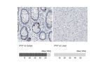 Immunohistochemistry analysis in human colon and liver tissues using HPA010973 antibody. Corresponding PYY RNA-seq data are presented for the same tissues.
