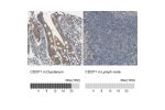 Immunohistochemistry analysis in human duodenum and lymph node tissues using HPA010978 antibody. Corresponding CDCP1 RNA-seq data are presented for the same tissues.