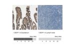 Immunohistochemistry analysis in human duodenum and lymph node tissues using HPA010979 antibody. Corresponding CDCP1 RNA-seq data are presented for the same tissues.