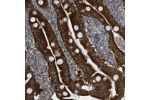 Immunohistochemical staining of human duodenum shows strong granular cytoplasmic positivity in glandular cells.