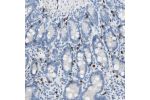 Immunohistochemical staining of human duodenum shows strong cytoplasmic positivity in a subset of leukocytes.