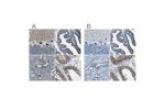 Immunohistochemical staining of human cerebellum, fallopian tube, kidney and testis using Anti-STIM1 antibody HPA011088 (A) shows similar protein distribution across tissues to independent antibody HPA012123 (B).