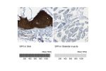 Immunohistochemistry analysis in human skin and skeletal muscle tissues using Anti-SFN antibody. Corresponding SFN RNA-seq data are presented for the same tissues.