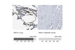 Immunohistochemistry analysis in human lung and skeletal muscle tissues using HPA011135 antibody. Corresponding MSN RNA-seq data are presented for the same tissues.