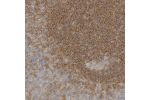 Immunohistochemical staining of human tonsil shows strong cytoplasmic positivity in reaction center cells.