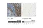 Immunohistochemistry analysis in human tonsil and cerebral cortex tissues using Anti-LAT antibody. Corresponding LAT RNA-seq data are presented for the same tissues.