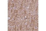Immunohistochemical staining of human cerebral cortex shows moderate cytoplasmic positivity in oligodendrocytes.