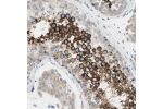 Immunohistochemical staining of human testis shows strong nuclear membranous and cytoplasmic positivity in cells in seminiferous ducts.