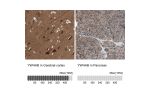 Immunohistochemistry analysis in human cerebral cortex and pancreas tissues using HPA011212 antibody. Corresponding YWHAB RNA-seq data are presented for the same tissues.