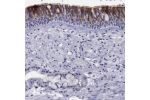 Immunohistochemical staining of human bronchus shows moderate cytoplasmic positivity in respiratory epithelial cells.