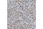 Immunohistochemical staining of human pancreas shows strong cytoplasm granular positivity in exocrine glandular cells.
