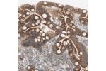 Immunohistochemical staining of human duodenum shows strong membranous positivity in glandular cells.